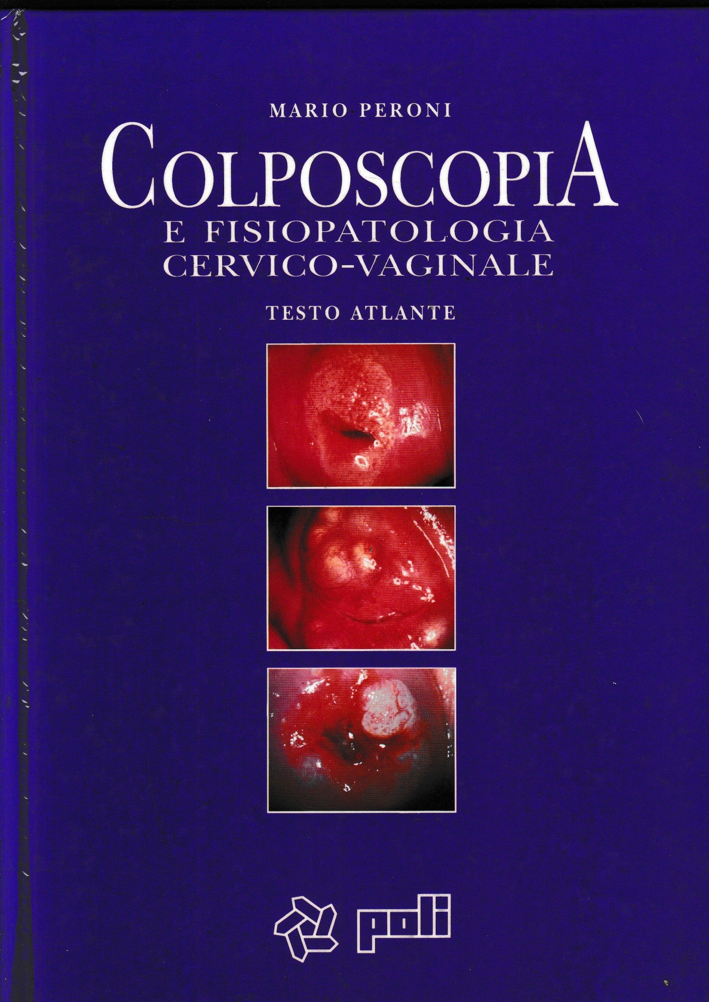 Colposcopia e fisiopatologia cervico-vaginale. Testo atlante - copertina