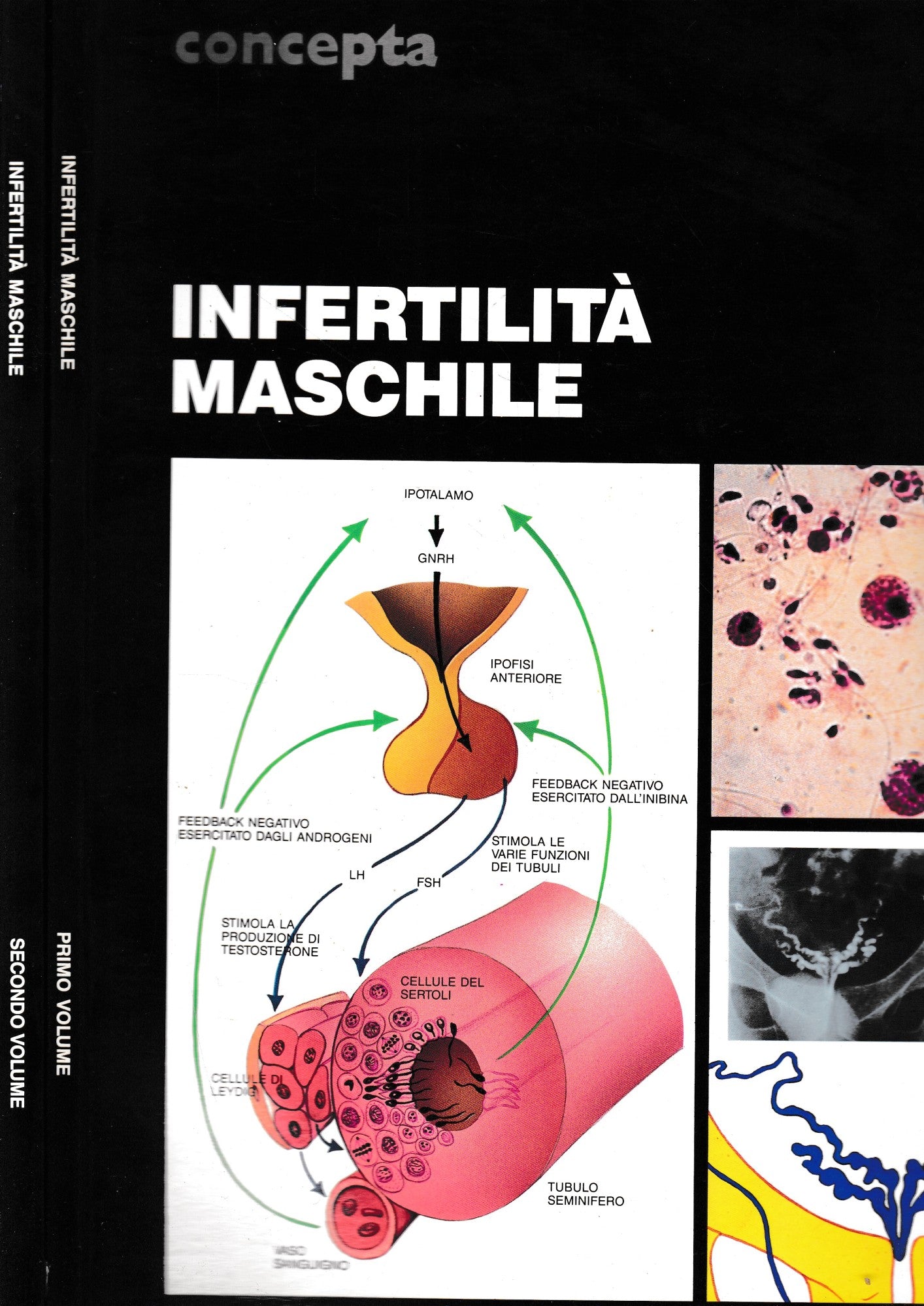 Infertilità maschile, due volumi - copertina