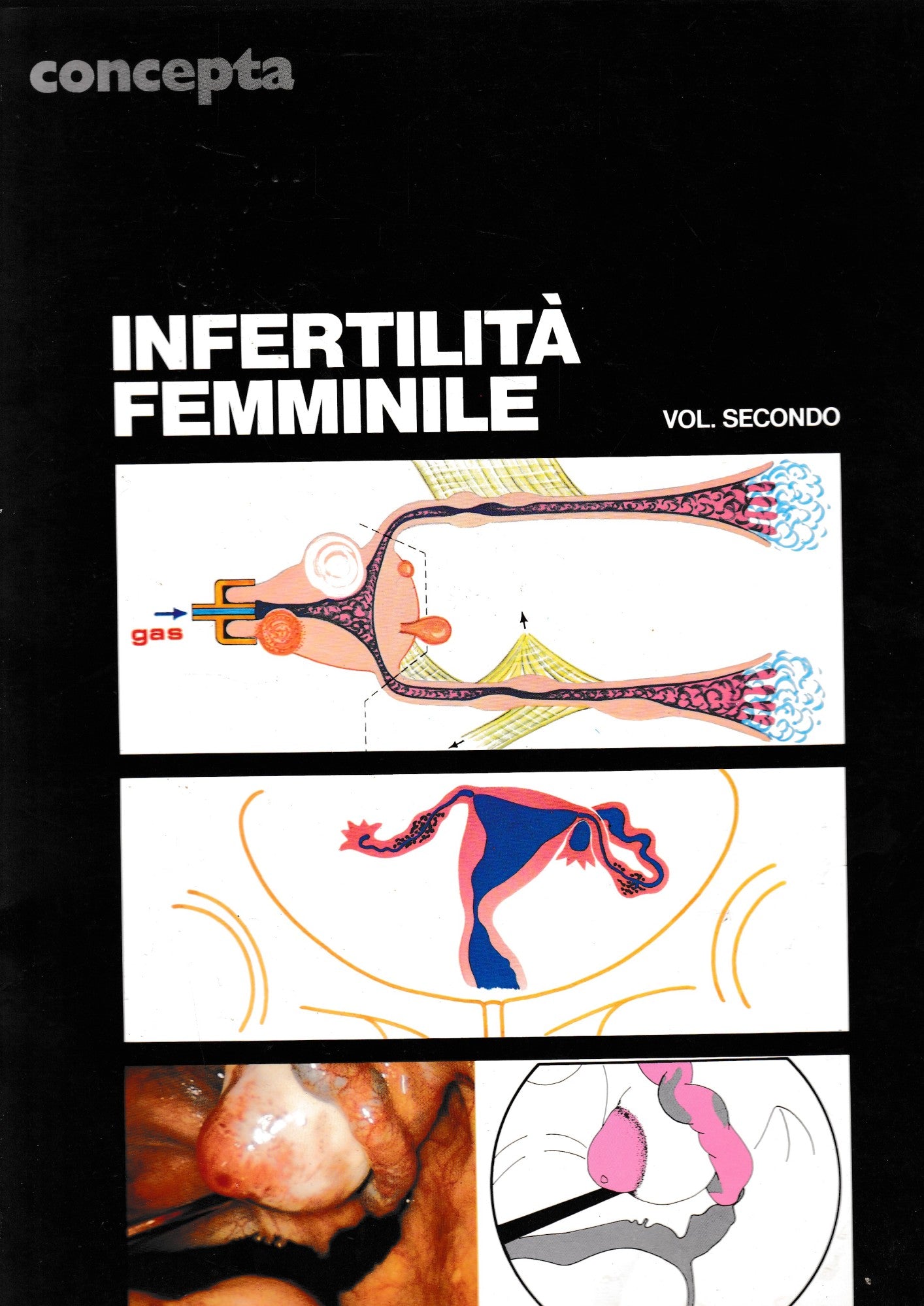 Infertilità femminile, volume 2° (un volume) - copertina