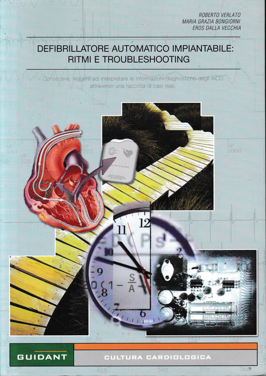 Defibrillatore automatico impiantabile: Ritmi e Troubleshooting - copertina