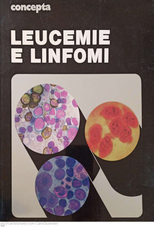Leucemie e linfomi - copertina