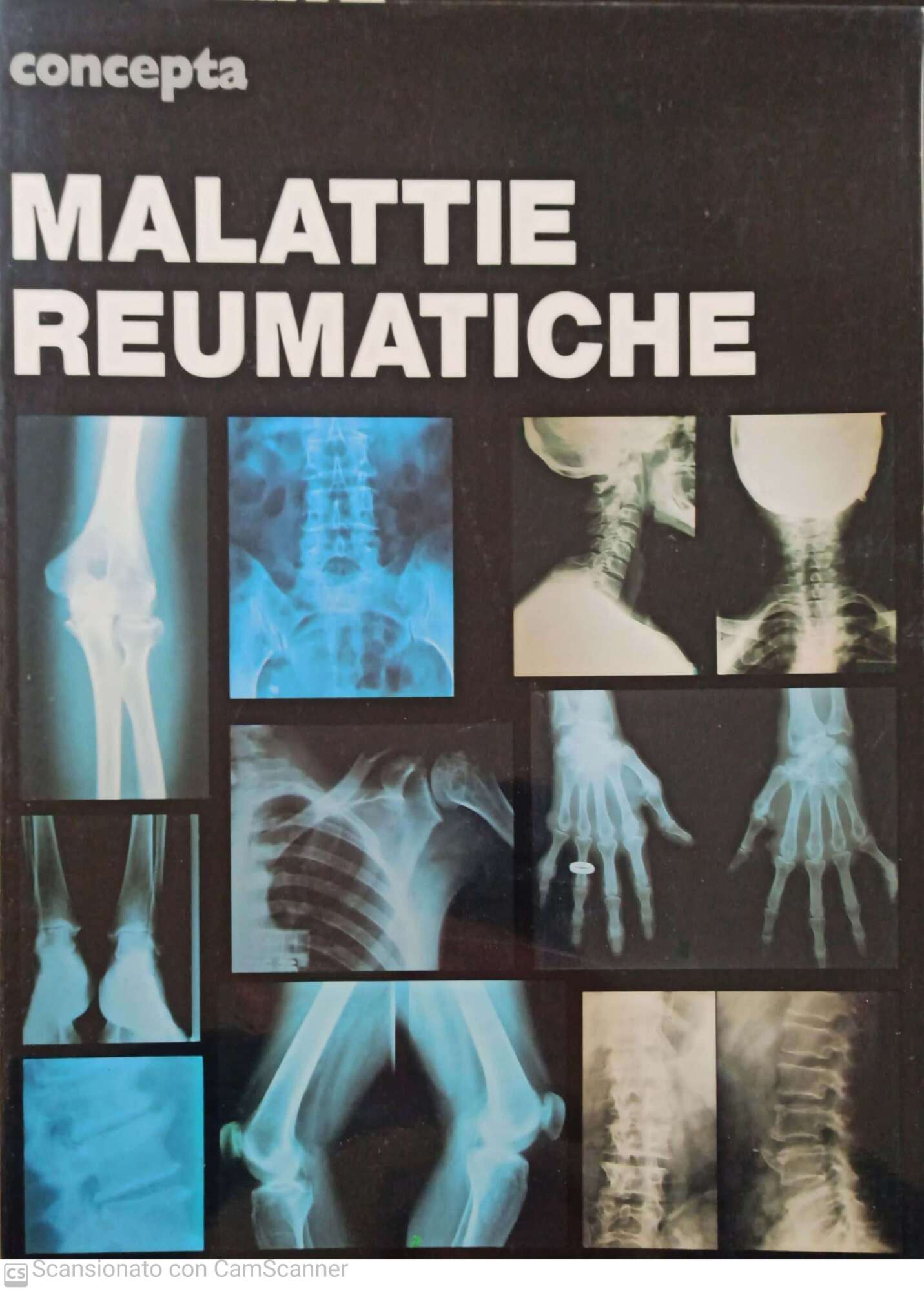 Malattie reumatiche - copertina