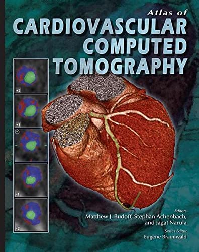 Atlas of Cardiovascular Computed Tomography. Edizione italiana. - copertina