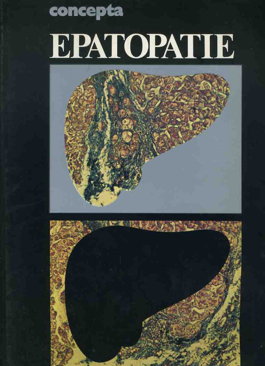 Epatopatie - copertina