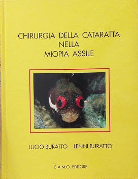 Chirurgia della cataratta nella miopia assile - copertina