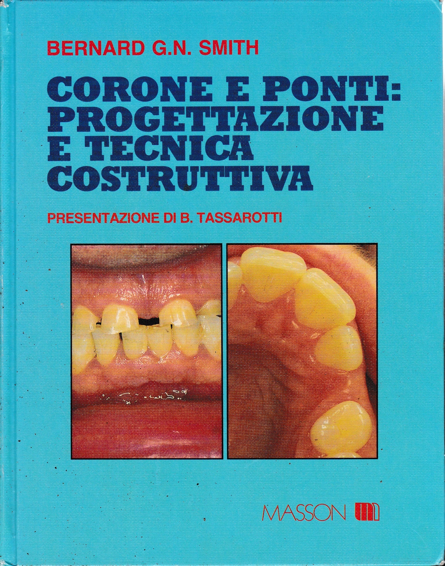 Corone e ponti: progettazione e tecnica costruttiva - copertina