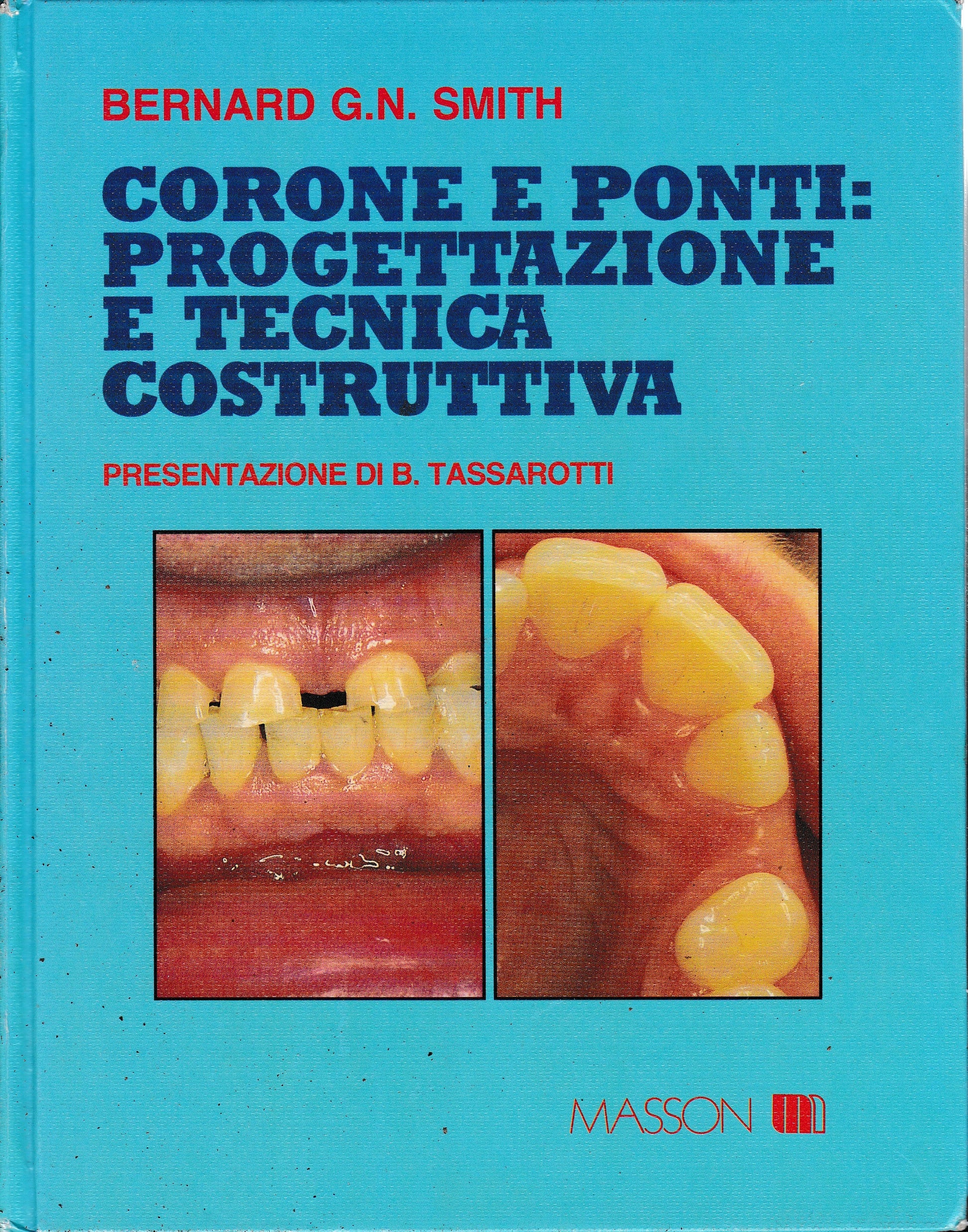 Corone e ponti: progettazione e tecnica costruttiva - copertina