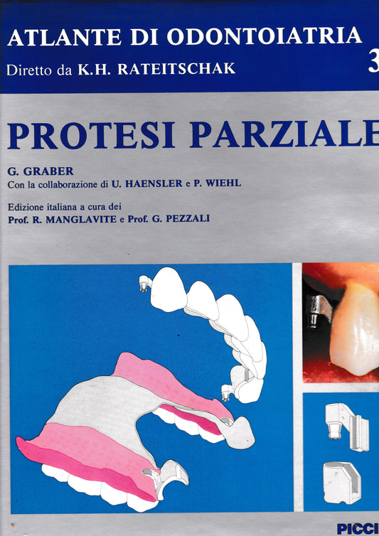 Atlante di Odontoiatria diretto da K. H. Rateitschak. Protesi parziale 3° vol. - copertina