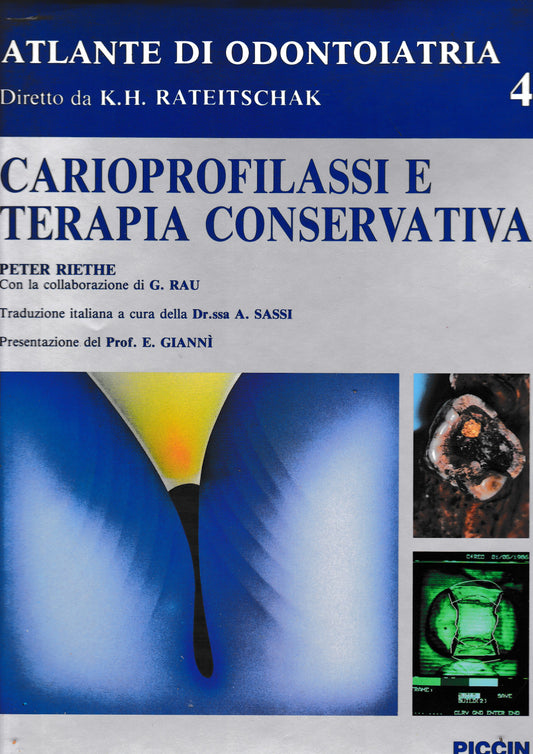 Atlante di Odontoiatria diretto da K. H. Rateitschak. Carioprofilassi e terapia conservativa 4° vol. - copertina