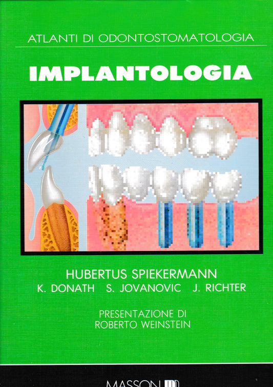 Atlanti di Odontostomatologia. Implantologia - copertina