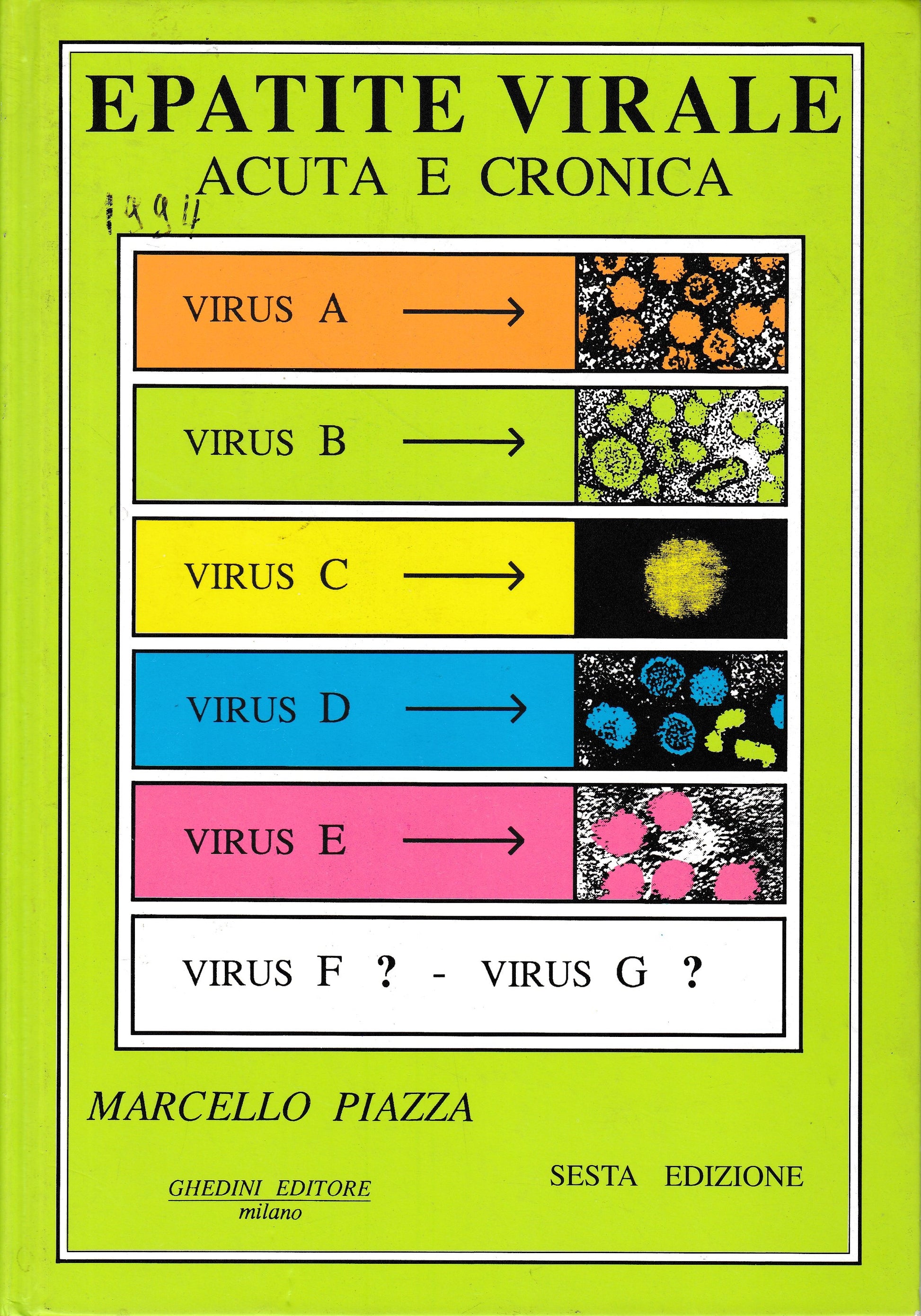 EPATITE VIRALE. Acuta e cronica. - copertina