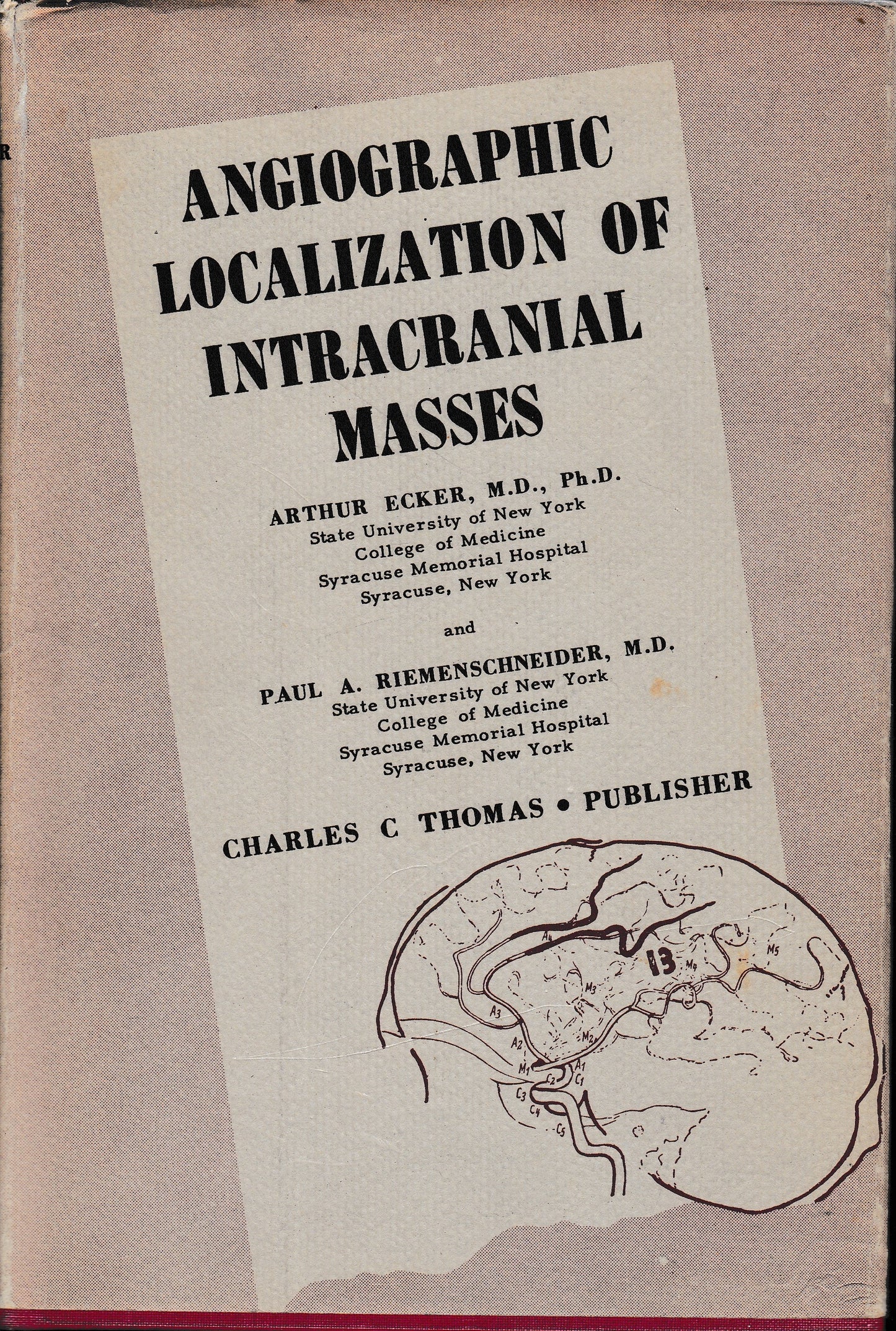 Angiographic Localization of Intracanial Masses - copertina